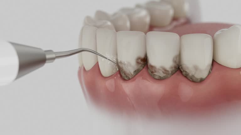 Reliable Dental Implants contractor in Palmview, TX by Smile Center Dentistry